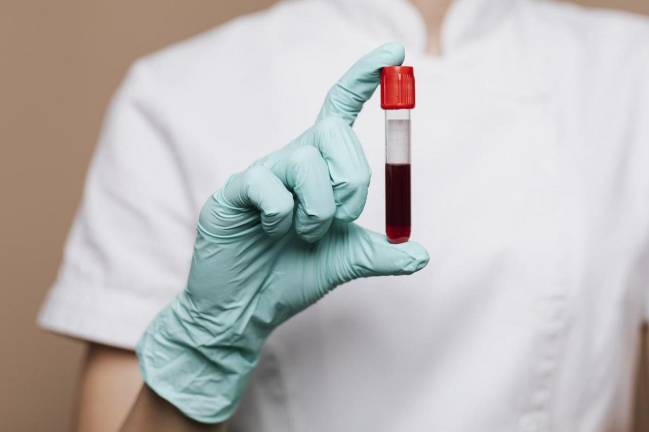 Сдача крови: какие выплаты положены донорам